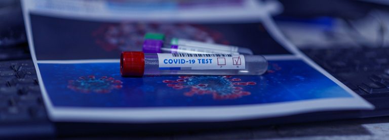 Siglato il protocollo d’intesa per i test antigenici rapidi nelle strutture sanitarie, validi per il Green Pass